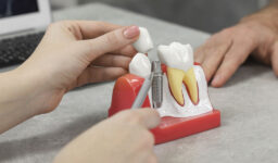 5 Ways to Maintain Your New Dental Implants in Winter